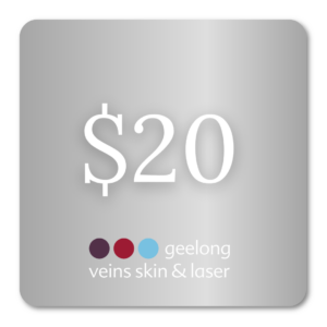 Geelong Veins Skin & Laser $20 gift voucher